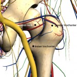 intertrochanteric femur